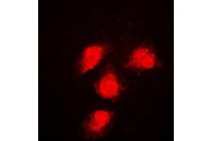 Immunofluorescent analysis of ERK1/2 staining in NIH3T3 cells. (ERK1/2 antibody  (Center))