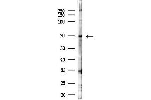 anti-Phospholipase A2, Group IVC (Cytosolic, Calcium-Independent) (PLA2G4C) (Internal Region) antibody