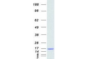 Western Blotting (WB) image for Fatty Acid Binding Protein 4, Adipocyte (FABP4) protein (Myc-DYKDDDDK Tag) (ABIN2720664)