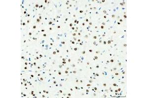 IHC analysis of DDX1 using anti-DDX1 antibody (ABIN7602052). (DDX1 antibody  (AA 562-740))