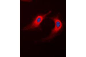 Immunofluorescent analysis of ABHD12B staining in K562 cells. (ABHD12B antibody  (C-Term))