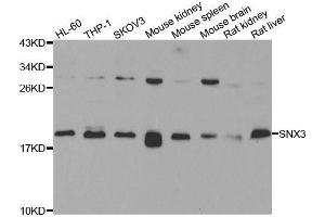Western blot analysis of extracts of various cell lines, using SNX3 antibody.