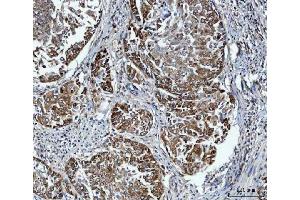 IHC analysis of FADS1 using anti-FADS1 antibody (ABIN7599175). (FADS1 antibody  (AA 1-257))