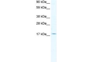 WB Suggested Anti-PQBP1 Antibody Titration: 2. (PQBP1 antibody  (Middle Region))