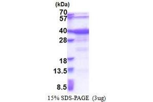 General Transcription Factor IIA, 1, 19/37kDa (GTF2A1) (AA 1-274) protein (His tag)
