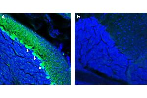 Expression of ADAM23 in mouse cerebellum.