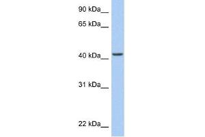 Human HeLa; WB Suggested Anti-ARID3C Antibody Titration: 0.
