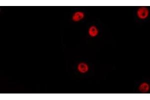 ABIN6275191 staining HepG2 by IF/ICC. (HOXA5 antibody  (Internal Region))