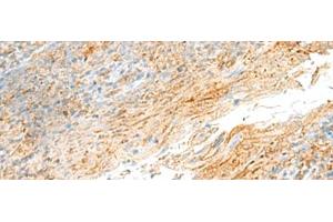 Immunohistochemistry of paraffin-embedded Human tonsil tissue using MRPS18B Polyclonal Antibody at dilution of 1:55(x200) (MRPS18B antibody)