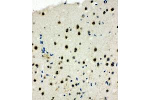 Anti-MCM6 antibody, IHC(P) IHC(P): Rat Brain Tissue (MCM6 antibody  (Middle Region))