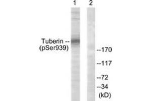 Western blot analysis of extracts from 293 cells treated with Anisomycin 25ug/ml 30', using Tuberin/TSC2 (Phospho-Ser939) Antibody. (Tuberin antibody  (pSer939))