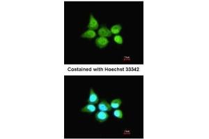 ICC/IF Image Immunofluorescence analysis of paraformaldehyde-fixed A431, using SSA1, antibody at 1:200 dilution. (TRIM21 antibody)