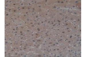 IHC-P analysis of Human Liver Tissue, with DAB staining. (Angiotensin I Converting Enzyme 1 antibody  (AA 1160-1306))