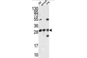 Western blot analysis of EN2 antibody (C-term) in 293 cell line lysates and mouse stomach and lung tissue lysates (35ug/lane). (EN2 antibody  (C-Term))