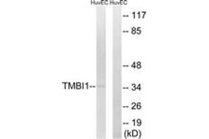 Western blot analysis of extracts from HuvEc cells, using TMBIM1 Antibody. (TMBIM1 antibody  (AA 251-300))