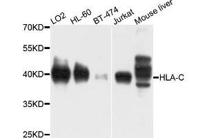Western blot analysis of extracts of various cells, using HLA-C antibody. (HLA-C antibody)