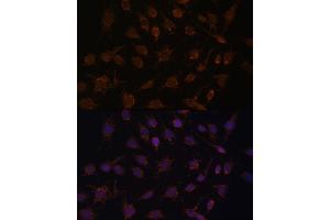 Immunofluorescence (IF) image for anti-Acetyl-CoA Acetyltransferase 1 (ACAT1) (AA 1-145) antibody (ABIN6136413)