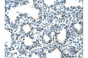 Image no. 1 for anti-Semenogelin I (SEMG1) (AA 51-100) antibody (ABIN203500) (SEMG1 antibody  (AA 51-100))