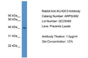 WB Suggested Anti-KLHDC3  Antibody Titration: 0. (KLHDC3 antibody  (N-Term))