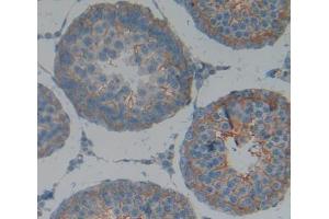 #VALUE! (CALY antibody  (AA 110-226))