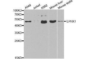 Western blot analysis of extracts of various cell lines, using EPHX1 antibody. (EPHX1 antibody  (AA 20-320))