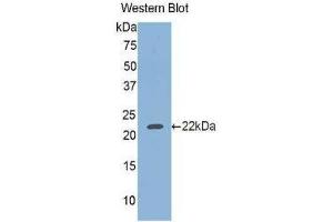 Western Blotting (WB) image for anti-Glucosidase, Beta, Acid (GBA) (AA 334-498) antibody (ABIN1858968)