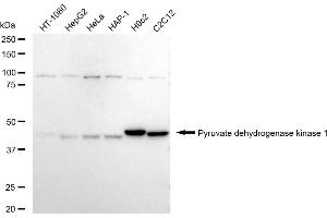 Western blotting analysis using Pyruvate dehydrogenase kinase 1 antibody (ABIN7800082).