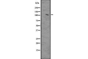 Western blot analysis of MAP3K14 expression in Ant NIK-transfected 293 cell lysate,The lane on the left is treated with the antigen-specific peptide.