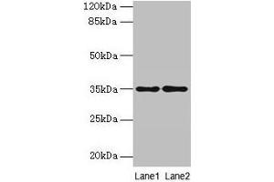 Western blot All lanes: SDSL antibody at 4 μg/mL Lane 1: HepG2 whole cell lysate Lane 2: Mouse liver tissue Secondary Goat polyclonal to rabbit IgG at 1/10000 dilution Predicted band size: 35 kDa Observed band size: 35 kDa (SDSL antibody  (AA 39-169))