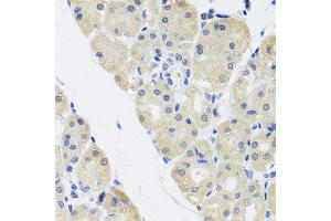 Immunohistochemistry of paraffin-embedded human gastric using ALAD antibody at dilution of 1:100 (x40 lens).