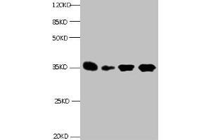 All lanes: Mouse anti- Human Insulin-like growth factor-binding protein 1 monoclonal antibody at 1 μg/mL Lane 1:Pyrolysis liquid human placental tissue 7. (IGFBPI antibody)