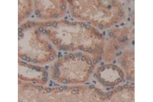 Figure. (IL21 Receptor antibody  (AA 23-185))