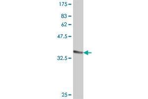 Western Blot detection against Immunogen (36. (PPIL1 antibody  (AA 76-166))