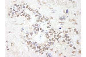 anti-Ankyrin Repeat and SAM Domain-Containing Protein 3 (ANKS3) (AA 606-656) antibody