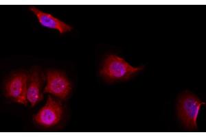 ABIN6257071 and ABIN6274969 staining Hela by IF/ICC.