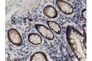 Immunoperoxidase of monoclonal antibody to STK38L on formalin-fixed paraffin-embedded human small Intestine. (STK38L antibody  (AA 1-464))