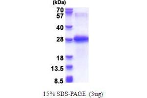 SDS-PAGE (SDS) image for Chondrolectin (CHODL) (AA 22-216) protein (His tag) (ABIN5853703) (CHODL Protein (AA 22-216) (His tag))