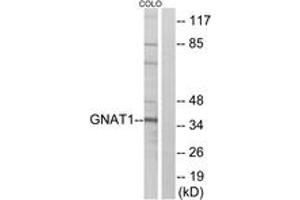 Western Blotting (WB) image for anti-Guanine Nucleotide Binding Protein (G Protein), alpha Transducing Activity Polypeptide 1 (GNAT1) (AA 71-120) antibody (ABIN1534969)
