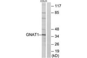 Western blot analysis of extracts from COLO cells, using GNAT1 Antibody. (GNAT1 antibody  (AA 71-120))