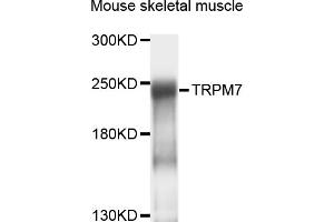 Western blot analysis of extracts of mouse skeletal muscle, using TRPM7 antibody (ABIN4905504) at 1:1000 dilution.