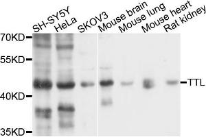 Western blot analysis of extracts of various cells, using TTL antibody.