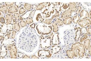Immunohistochemical analysis of paraffin-embedded Human kidney section using Pink1 (ABIN1538954 and ABIN2849886). (FH antibody  (N-Term))