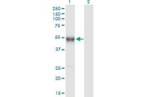 Western Blot analysis of IGHG4 expression in transfected 293T cell line by IGHG4 MaxPab polyclonal antibody. (IGHG4 antibody  (AA 1-473))