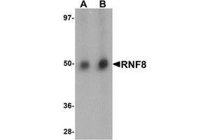 Western blot analysis of RNF8 in human lung tissue lysate with RNF8 antibody at (A) and (B) 2 μg/ml. (RNF8 antibody  (C-Term))