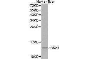 Western Blotting (WB) image for anti-Serum Amyloid A1 (SAA1) (AA 19-122) antibody (ABIN6218744) (SAA1 antibody  (AA 19-122))