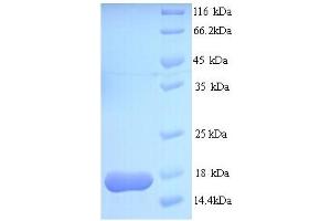 SDS-PAGE (SDS) image for ATP-Binding Cassette, Sub-Family B (MDR/TAP), Member 1B (ABCB1B) (AA 1-114), (full length) protein (His tag) (ABIN4974034) (ATP-Binding Cassette, Sub-Family B (MDR/TAP), Member 1B (ABCB1B) (AA 1-114), (full length) protein (His tag))