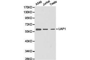 Western Blotting (WB) image for anti-UDP-N-Acteylglucosamine Pyrophosphorylase 1 (UAP1) antibody (ABIN1875243) (UAP1 antibody)