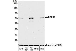 Western Blotting (WB) image for anti-Forkhead Box Q1 (FOXQ1) (AA 353-403) antibody (ABIN7455177)