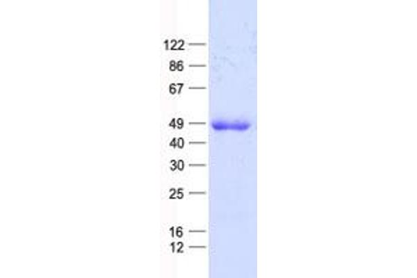 E2F5 Protein (E2F5) (His tag)