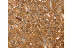 Immunohistochemistry (IHC) image for anti-Thymosin beta 10 (TMSB10) antibody (ABIN2433967) (Thymosin beta 10 antibody)